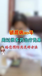 銀屑病20年用過(guò)很多藥治療無(wú)果給您預(yù)防消退好方法