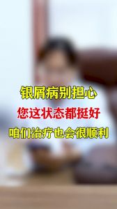 银屑病别担心您这状态都挺好咱们治疗也会很顺利