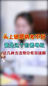 頭上銀屑病老不好竟是因為這個因素導致這幾種方法幫你有效緩解