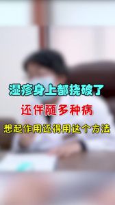 濕疹身上都撓破了還伴隨多種病想起作用還得用這個(gè)方法