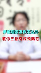 手部濕疹發(fā)作怎么辦教你三招有效預(yù)防它