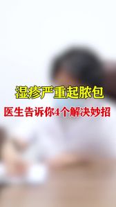 湿疹严重起脓包医生告诉你4个解决妙招