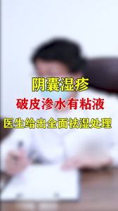 阴囊湿疹破皮渗水有粘液医生给出全面祛湿处理