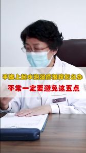 手脚上起小水泡湿疹很痒怎么办这五点一定要避免