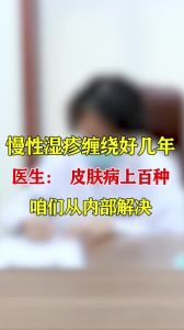 慢性湿疹缠绕好几年医生：皮肤病上百种咱们从内部解决