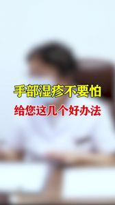 手部濕疹不要怕給您這幾個好辦法