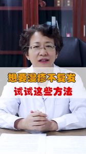 想要湿疹不复发试试这些方法