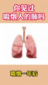 你见过吸烟人的肺吗