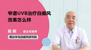 窄譜UVB治療白癜風(fēng)效果怎么樣  