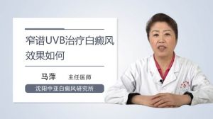 窄譜UVB治療白癜風(fēng)效果如何