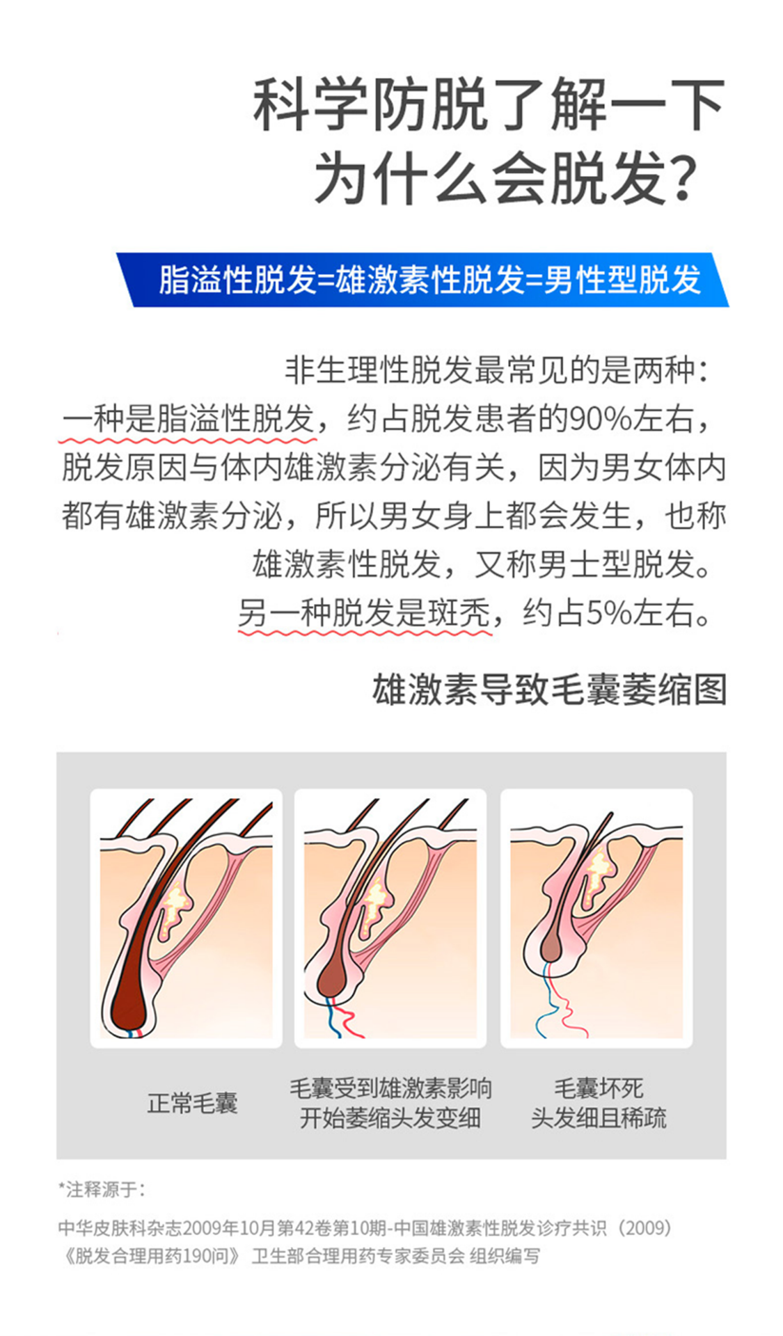脱发