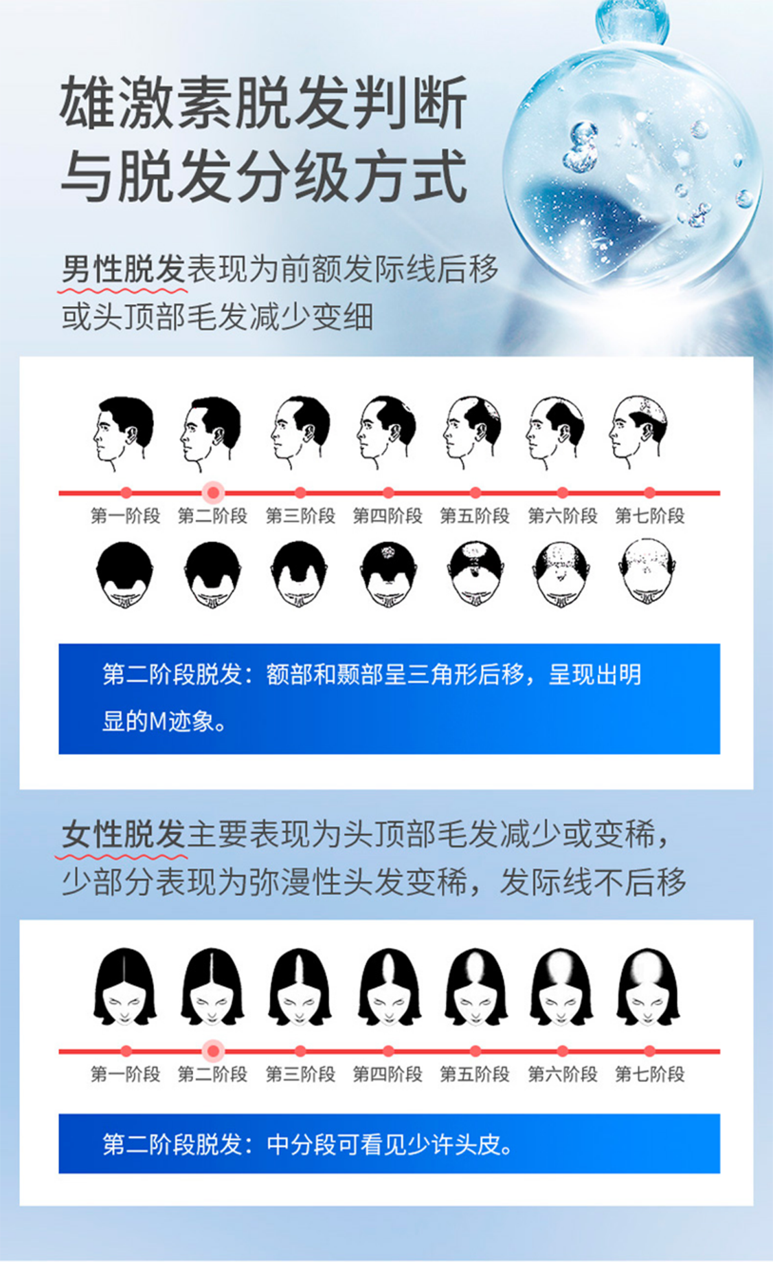脱发