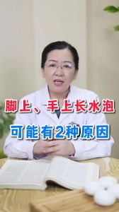 脚上手上长水泡 可能有2种原因